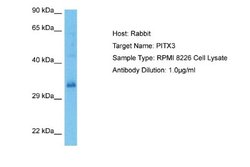 PITX3 Rabbit anti-Human, Polyclonal, Novus Biologicals 0.1ml; Unconjugated:Antibodies,